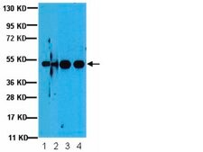 Anti-GSK-3b Antibody, a.a. 335-349 from rabbit, purified by affinity chromatography