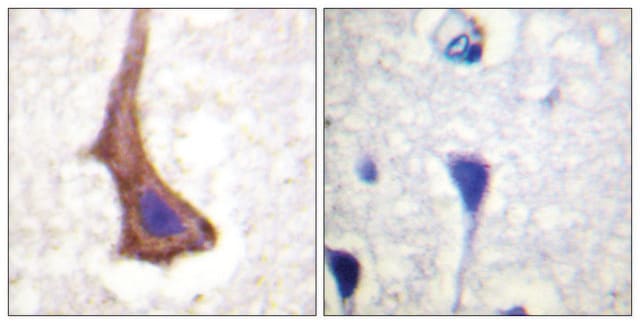 Anti-CSFR antibody produced in rabbit affinity isolated antibody