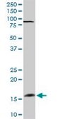 Anti-FGF1 antibody produced in rabbit purified immunoglobulin, buffered aqueous solution