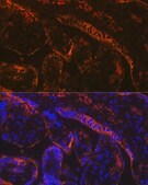Anti-Aromatase (CYP19A1) Antibody, clone 5C5N7, Rabbit Monoclonal