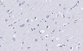 Anti-LC3A Antibody, clone 3J12 ZooMAb&#174; Rabbit Monoclonal recombinant, expressed in HEK 293 cells