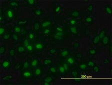 Monoclonal Anti-TOP2A antibody produced in mouse clone 1E2, purified immunoglobulin, buffered aqueous solution