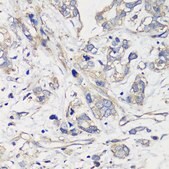 Anti-TNF-&#945; antibody produced in rabbit