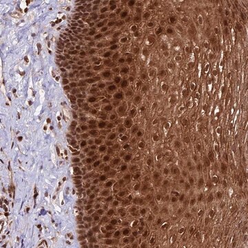 Anti-DHX38 antibody produced in rabbit Prestige Antibodies&#174; Powered by Atlas Antibodies, affinity isolated antibody, buffered aqueous glycerol solution