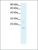 Anti-CLDN1 antibody produced in rabbit affinity isolated antibody