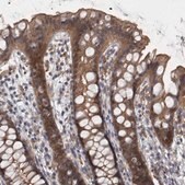 Anti-PRKCI antibody produced in rabbit affinity isolated antibody, buffered aqueous glycerol solution
