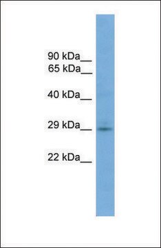 Anti-TMEM139, (N-terminal) antibody produced in rabbit affinity isolated antibody