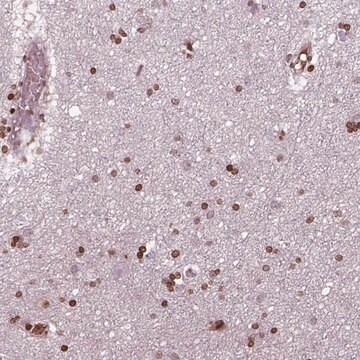Anti-PIP4K2A antibody produced in rabbit Prestige Antibodies&#174; Powered by Atlas Antibodies, affinity isolated antibody, buffered aqueous glycerol solution