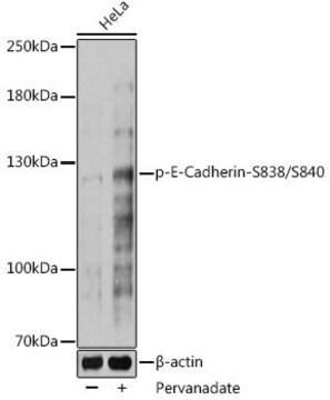 Anti-Phospho-CDH1-S838/S840 antibody produced in rabbit