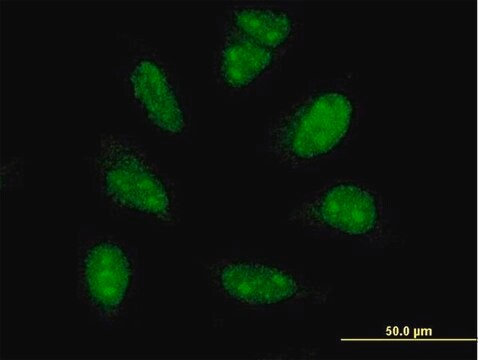 ANTI-PIM1 antibody produced in mouse clone 1C10, purified immunoglobulin, buffered aqueous solution