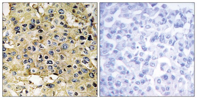 Anti-ENTK antibody produced in rabbit affinity isolated antibody