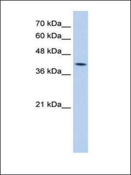 Anti-M6PR antibody produced in rabbit IgG fraction of antiserum