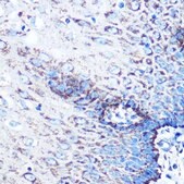 Anti-MMP3 antibody produced in rabbit