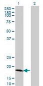 Monoclonal Anti-CDKN2D antibody produced in mouse clone 2E10, purified immunoglobulin, buffered aqueous solution