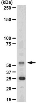 Anti-Calmodulin Binding Protein Epitope Tag Antibody, clone C16T, rabbit monoclonal culture supernatant, clone C16T, from rabbit