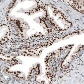 Monoclonal Anti-AR antibody produced in mouse Prestige Antibodies&#174; Powered by Atlas Antibodies, clone CL9255, purified immunoglobulin, buffered aqueous glycerol solution