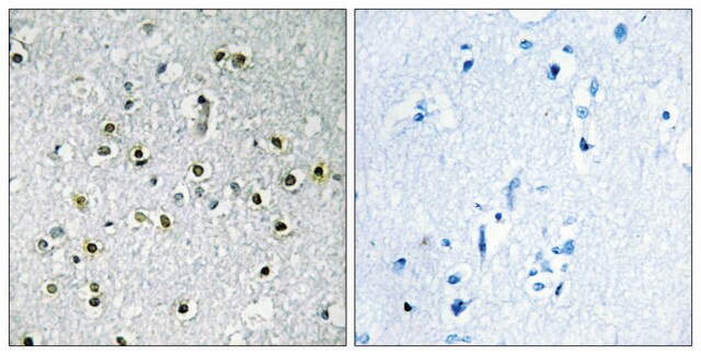 Anti-TFE3 antibody produced in rabbit affinity isolated antibody