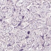 Anti-CYP11B1 antibody produced in rabbit Prestige Antibodies&#174; Powered by Atlas Antibodies, affinity isolated antibody, buffered aqueous glycerol solution