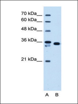 Anti-AKR1B1 antibody produced in rabbit IgG fraction of antiserum