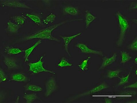 Monoclonal Anti-EXOSC8, (C-terminal) antibody produced in mouse clone 4B3, purified immunoglobulin, buffered aqueous solution