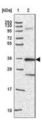 Anti-CAMK2A antibody produced in rabbit Prestige Antibodies&#174; Powered by Atlas Antibodies, affinity isolated antibody, buffered aqueous glycerol solution