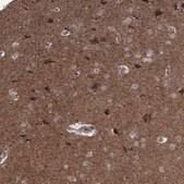 Anti-MAPK8IP2 antibody produced in rabbit Prestige Antibodies&#174; Powered by Atlas Antibodies, affinity isolated antibody, buffered aqueous glycerol solution