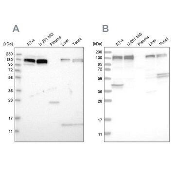 Anti-ERC1 antibody produced in rabbit Prestige Antibodies&#174; Powered by Atlas Antibodies, affinity isolated antibody, buffered aqueous glycerol solution, Ab1