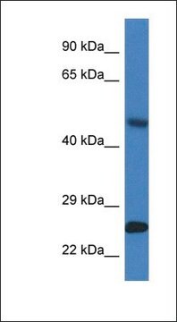 Anti-SNX10 antibody produced in rabbit affinity isolated antibody