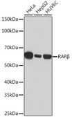 Anti-RAR&#946; Antibody, clone 6D5V4, Rabbit Monoclonal