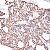 Anti-GABA transaminase (ABAT) Antibody, clone 10V1K9, Rabbit Monoclonal