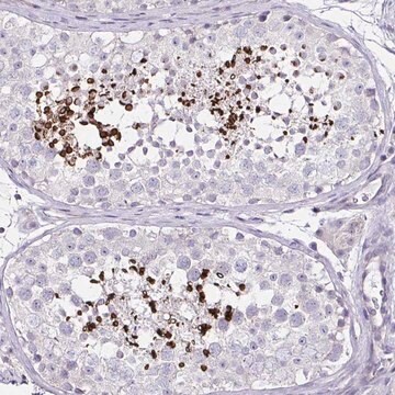 Anti-D2HGDH antibody produced in rabbit Prestige Antibodies&#174; Powered by Atlas Antibodies, affinity isolated antibody, buffered aqueous glycerol solution