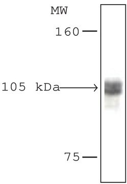 Anti-Histone Deacetylase 7 (HDAC7) (YS-19) antibody produced in rabbit affinity isolated antibody, buffered aqueous solution