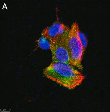 Anti-TRPA1 Antibody, clone 2N14 ZooMAb&#174; Rabbit Monoclonal recombinant, expressed in HEK 293 cells