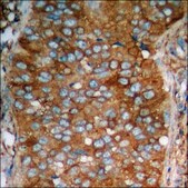 Anti-phospho-PKA CAT (pThr197) antibody produced in rabbit affinity isolated antibody