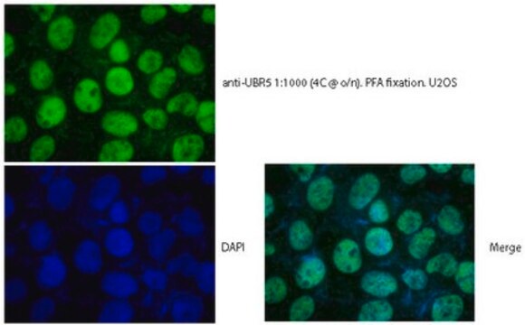 Anti-E3 ubiquitin-protein ligase (UBR5/EDD) serum, from rabbit