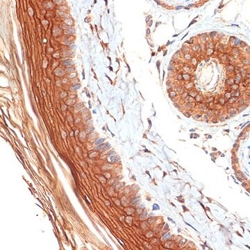 Anti-PERP antibody produced in rabbit