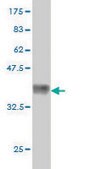 Monoclonal Anti-CACNB2 antibody produced in mouse clone 6C1, purified immunoglobulin, buffered aqueous solution