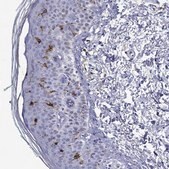 Anti-CD1A antibody produced in rabbit Prestige Antibodies&#174; Powered by Atlas Antibodies, affinity isolated antibody, buffered aqueous glycerol solution