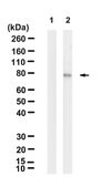 Anti-p-PKC&#946; (Ser660) Antibody, clone 2C11 ZooMAb&#174; Rabbit Monoclonal recombinant, expressed in HEK 293 cells