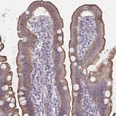 Anti-SSTR1 antibody produced in rabbit Prestige Antibodies&#174; Powered by Atlas Antibodies, affinity isolated antibody, buffered aqueous glycerol solution