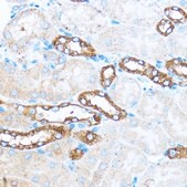 Anti-PIK3CA antibody produced in rabbit