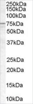 Anti-ACSL5 antibody produced in goat affinity isolated antibody, buffered aqueous solution