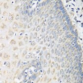 Anti-OXCT1 antibody produced in rabbit