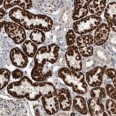 Anti-ACSF2 antibody produced in rabbit Prestige Antibodies&#174; Powered by Atlas Antibodies, affinity isolated antibody, buffered aqueous glycerol solution