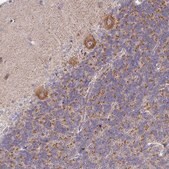 Anti-PRKCH antibody produced in rabbit Prestige Antibodies&#174; Powered by Atlas Antibodies, affinity isolated antibody, buffered aqueous glycerol solution