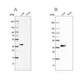 Anti-ARG1 antibody produced in rabbit Prestige Antibodies&#174; Powered by Atlas Antibodies, affinity isolated antibody, buffered aqueous glycerol solution