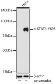 Anti-Phospho-STAT4-Y693 antibody produced in rabbit