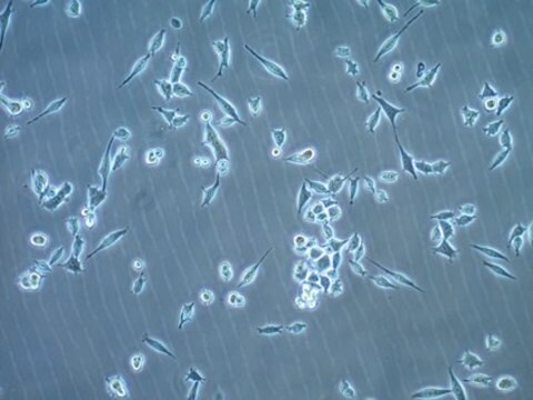 MB49 Mouse Bladder Carcinoma Cell Line MB49 mouse urothelial carcinoma cell line is widely used as an in vitro and in vivo model of bladder cancer.