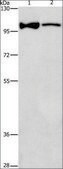 Anti-ADCY3 antibody produced in rabbit affinity isolated antibody