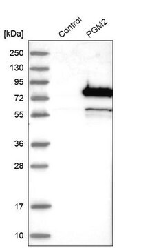 Anti-PGM2 antibody produced in rabbit Prestige Antibodies&#174; Powered by Atlas Antibodies, affinity isolated antibody, buffered aqueous glycerol solution